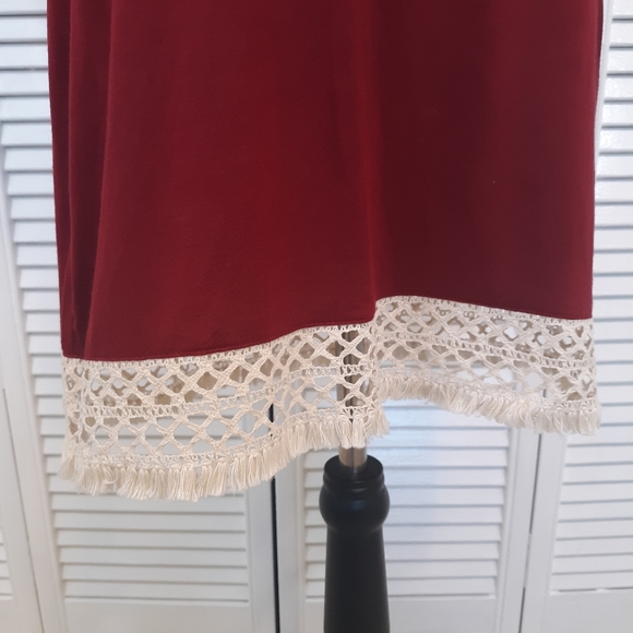 Young threads NYC lace dress medium - Picture 4 of 8